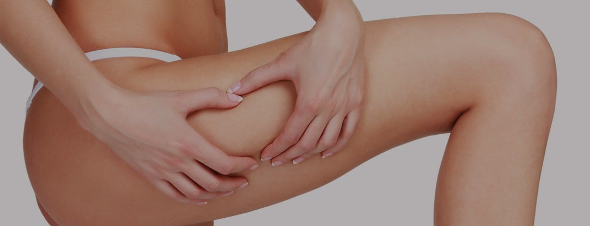 pernas de mulher após tratamento da flacidez